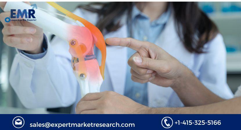 Knee Replacement Market Size, Share Growth, 2023-2031