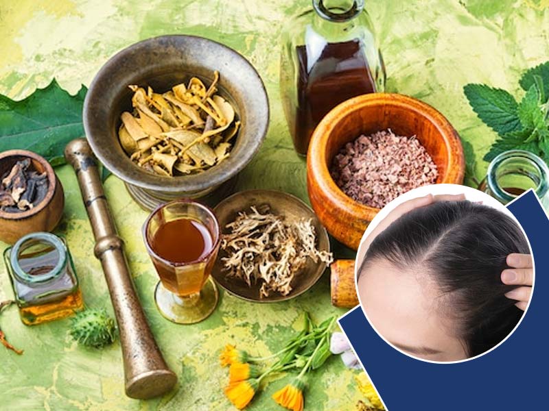 Top 10 Tips on How to Regrow Hair on Bald Spot Fast