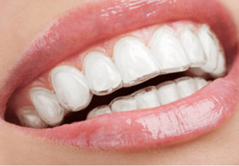 Achieving Perfect Smiles: SmileWorks Brings Quality Kids and Adult Braces to New York City